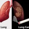 Cảnh Báo An Toàn: Trẻ Nhỏ Có Nguy Cơ Nuốt Dị Vật Nguy Hiểm