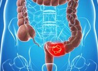 Giải Quyết Vấn Đề Bí Tiểu Ở Người Cao Tuổi: Nguyên Nhân Và Phương Pháp Điều Trị