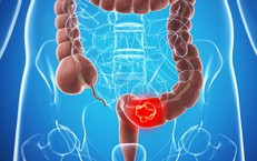 Giải Quyết Vấn Đề Bí Tiểu Ở Người Cao Tuổi: Nguyên Nhân Và Phương Pháp Điều Trị