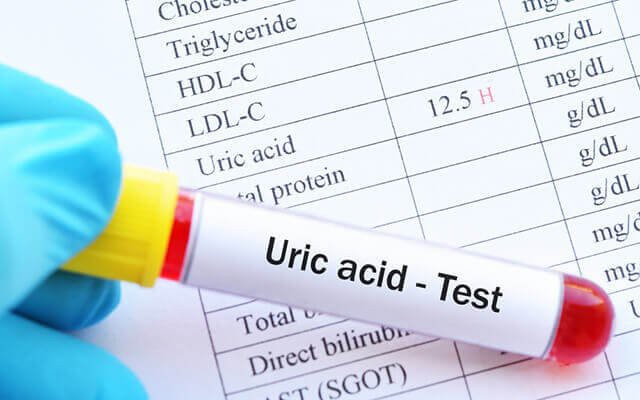 Uống nước chanh mật ong mỗi ngày có làm tăng acid uric? - Ảnh 3.