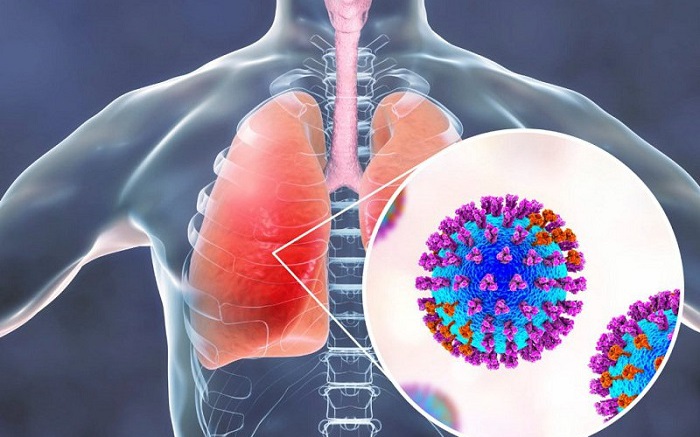 Dấu Hiệu Cần Nhận Biết Viêm Phổi Do Adenovirus Ở Trẻ