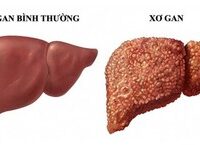 Tác Động của Làm Ca Đêm Đến Sức Khỏe và Cách Giảm Thiểu Hậu Quả