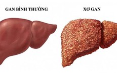 Tác Động của Làm Ca Đêm Đến Sức Khỏe và Cách Giảm Thiểu Hậu Quả