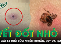 Nguy Cơ Từ Thói Quen Ăn Uống: Cảnh Báo Về Suy Thận Từ Thực Phẩm Hâm Lại