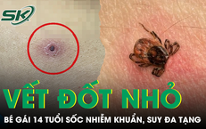 Nguy Cơ Từ Thói Quen Ăn Uống: Cảnh Báo Về Suy Thận Từ Thực Phẩm Hâm Lại