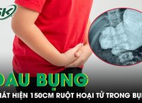 Hậu Quả Nghiêm Trọng Từ Việc Để Nước Mưa Dính Lên Khuôn Mặt