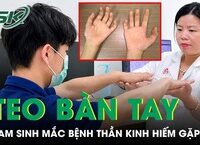 Cà Tím: Lợi Ích Cụ Thể Trong Việc Kiểm Soát Đường Huyết