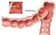 Dấu hiệu cảnh báo: Khi nào phải đưa trẻ sốt vào viện?