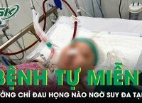 Cảnh Báo Sức Khỏe: Hệ Lụy Nghiêm Trọng Khi Chỉ Uống Nước Trong 15 Ngày