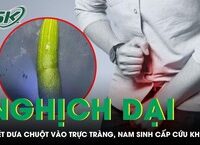 Khi một xe đạp bị ôtô tông: phân tích rủi ro và cách xử lý an toàn