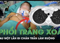 Người Bán Trái Cây Phát Hiện Bệnh Ung Thư Gan Sau Khi Thói Quen Ăn Uống Bình Thường