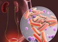 Lưỡi bản đồ: nhận biết, lý do thường gặp và cách chăm sóc hàng ngày