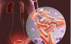 Lưỡi bản đồ: nhận biết, lý do thường gặp và cách chăm sóc hàng ngày