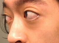 Lưu Ý Quan Trọng Cho Người Bệnh Tim Khi Sử Dụng Thuốc Cường Dương