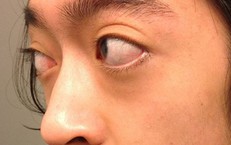 Lưu Ý Quan Trọng Cho Người Bệnh Tim Khi Sử Dụng Thuốc Cường Dương