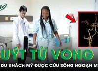 Cảnh Giác Về Tình Trạng Sức Khỏe: Khi Cơn Đau Họng Ẩn Chứa Mối Nguy Hiểm Nghiêm Trong
