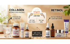 Calo trong quả bơ và cách ăn bơ thông minh để không tăng cân