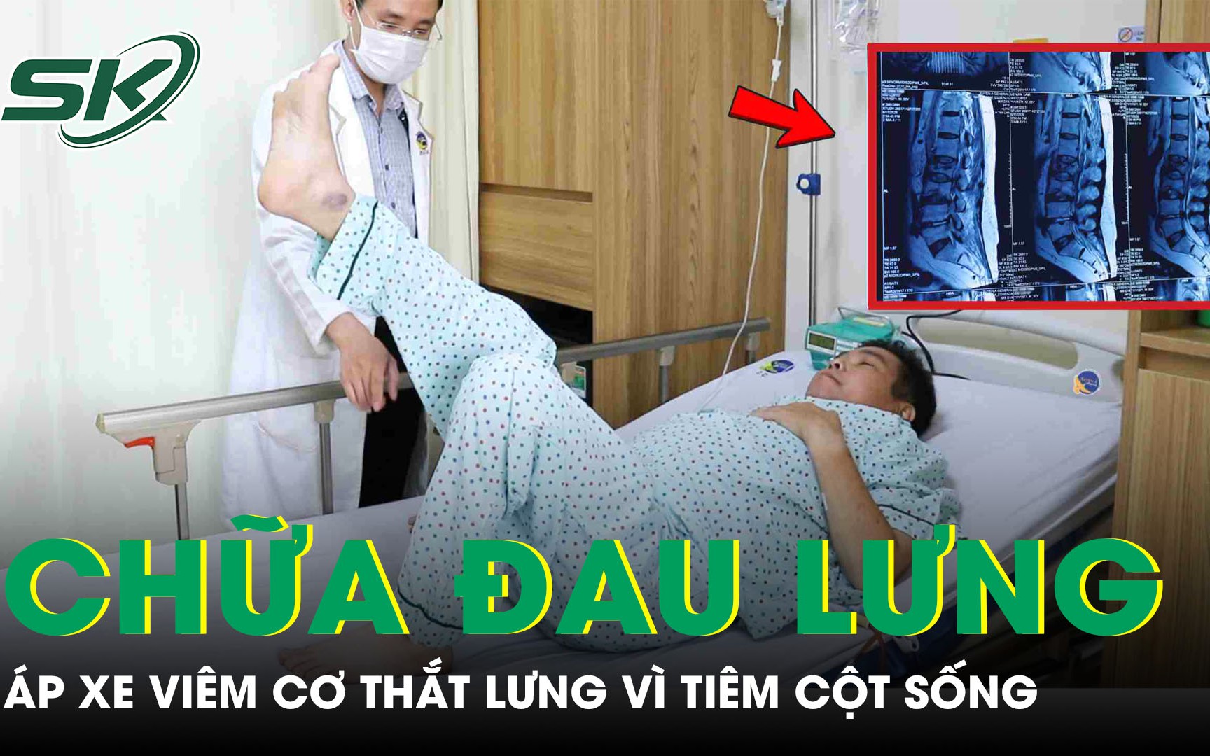 Nội soi một cổng trong điều trị trượt đốt sống: lựa chọn ít xâm lấn, phục hồi nhanh
